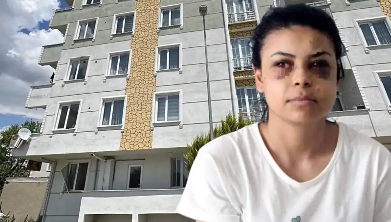 Düğünde Maganda Dehşeti: Damat Gözünden Vuruldu, Tüyler Ürpertti
