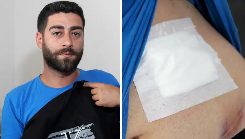 Karnında Ağrı Hissetti, Röntgen Sonrası Şok Edici Gerçek Ortaya Çıktı!