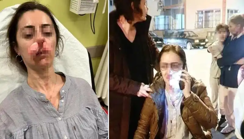 Eşinin Sevgilisini Sanıp Otomobil Kapısıyla Saldırdı: Silah Değeri Taşıyan Olay